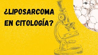 LIPOSARCOMA Diagnóstico citológico Tumores de partes blandas [upl. by Nyliac]