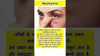 Whats myokymia healthfacts health medical medicalfacts healthcare medicaleducation shorts [upl. by Kissiah261]