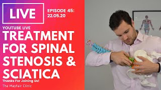 Treatment For Spinal Stenosis amp Sciatica [upl. by Aymik]