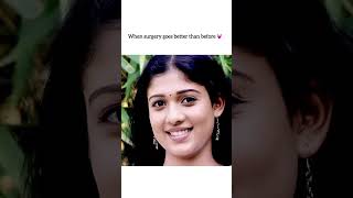 When surgery goes better than before 💕🔥NayantharaShortsTrending [upl. by Ahseekal]