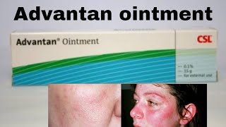 Advantan ointment  Use  Side Effects  Benefits  price review skincare beauty [upl. by Rovaert]