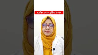 স্ক্যাবিস থেকে মুক্তির উপায় II scabiestreatment treatment [upl. by Octavla]