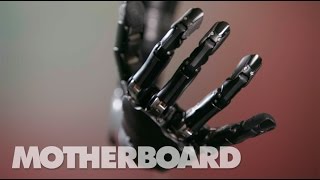 The MindControlled Bionic Arm With a Sense of Touch [upl. by Dylan]