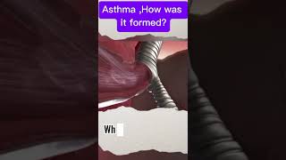 Asthma A 3D Look Inside Your Lungs asthma 3Danimation health lungs breathing [upl. by Aissenav]