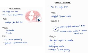 OSTEOCHONDROMA amp OSTEOID OSTEOMA NOTES ONE PAGE NOTES  ORTHOPAEDICS  4TH PROFF  MBBS [upl. by Foy]