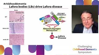 Preclinical treatments for Lafora disease  a childhood dementia driven by perturbed metabolism [upl. by Dallon824]