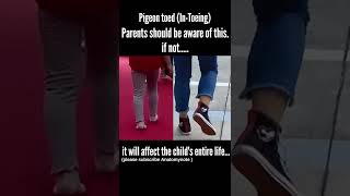 Pigeon Toed walking Intoeing baby walking  parents should be aware of shorts [upl. by Ayotna369]