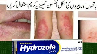 Hydrozole Cream Uses  Tee fatima [upl. by Sitnik]