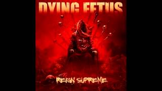 Dying Fetus  Second Skin [upl. by Supmart]