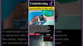 Colposcopy [upl. by Atinauj]