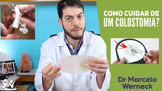 Como cuidar de uma colostomia  COM DEMONSTRAÇÃO [upl. by Dranoel]