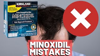 5 BIGGEST MISTAKES When Using Minoxidil REVEALED [upl. by Tullusus]