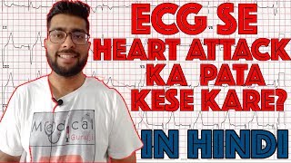 ECG reading in Hindi Language part 2  How to read ECG signal part 2  Medical Guruji [upl. by Oman525]