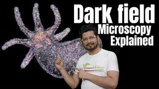 Dark field microscopy explained  Dark field microscope principle [upl. by Draneb]