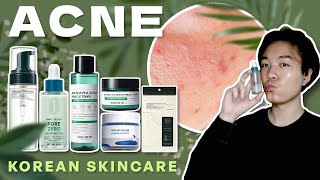 ACNE Treatment  6 Korean Skincare for Oily amp Acne Prone Skin 💦 🇰🇷 [upl. by Lemcke]