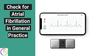 Easy way to check for atrial fibrillation in General Practice  with Alivekor Kardia [upl. by Vi]