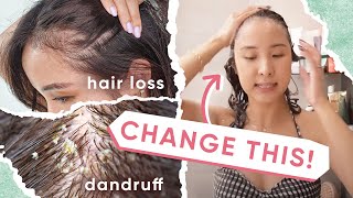 4 Reasons WHY Your Hair Loss amp Dandruff ISN’T Getting BETTER  5 TIPS [upl. by Atelra]