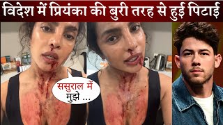 Priyanka Chopra Shocking Video Viral on Social Media Fans Worried after Seeing Her [upl. by Retha487]