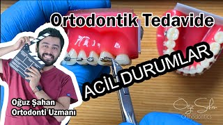 Ortodontik Tedavide Acil Durumlar  Telim çıktı ne yapmalıyım  DrOğuz Şahan [upl. by Sabina]