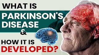 What is Parkinsons Disease amp How It Is Developed Introduction [upl. by Ettenirt]