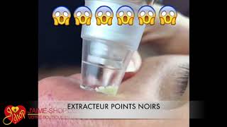 EXTRACTEUR POINTS NOIRS [upl. by Nnaillij296]