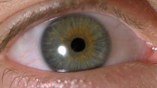 My Iris Wobbles  Eye In Slow Motion [upl. by Humbert252]