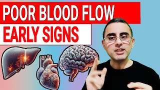 6 Signs Your Bodys CIRCULATION Is FAILING  Circulatory Disturbance [upl. by Brufsky216]