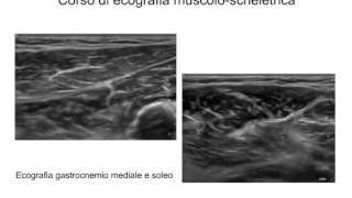 Corso Base di Ecografia Muscoloscheletrica [upl. by Cawley]