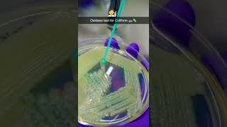 Oxidase test for coliform 🧫🧪🧫microbiologist microbiology bacteria virus fungi microbs [upl. by Rosco209]