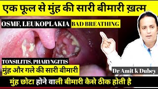 इस एक फूल को चबाने से ठीक होती है ।। Tonsilitis ।। Pharangitis।। Dental एब्सिसेज ।। OSMF [upl. by Bucky]