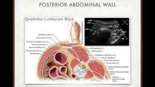 TAP block in clinical practice [upl. by Tristis]