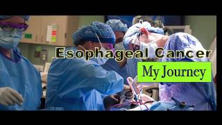 Esophageal Cancer My Journey 9 [upl. by Haisoj]