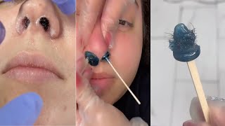 Parlour Mein Nose Waxing Kaise Hota Hai part4😱 [upl. by Tnayrb]