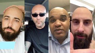 BALD MEN Tell You How They Accepted Their Hairloss And Went Bald [upl. by Philina814]