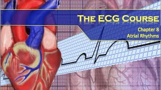 The ECG Course  Atrial Rhythms [upl. by Ardnaeed140]