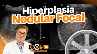 COMO RECONHECER HIPERPLASIA NODULAR FOCAL I VOCÊ RADIOLOGISTA [upl. by Ydnar12]