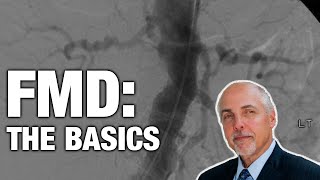 Fibromuscular Dysplasia  Clinical Essentials [upl. by Bertrand284]