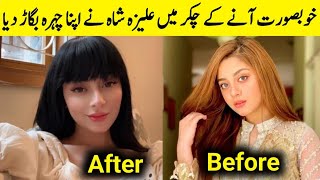 Aliza shah surgery goes wrong after look of surgery alizeyshah [upl. by Oileduab]