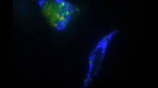 Caspase inhibition and mitophagy monitored by FRET in Hela cells undergoing apoptosis [upl. by Jacie]