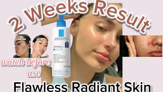 Best safe body lotion 2024✅ Laroche posay triple repair moisturizing creamReview clear skin [upl. by Yennek783]