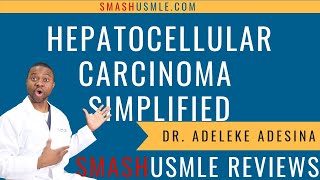 Hepatocellular Carcinoma Lecture Simplified [upl. by Brennen252]