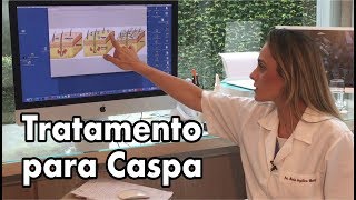 Tratamento para Caspa [upl. by Arayt458]