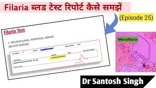 How To Read Filaria Blood Test Report Dr Santosh Singh Episode 25 [upl. by Drarrej]