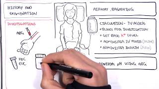 Diabetic Ketoacidosis Diabetes Type I Management Summary [upl. by Hugibert]