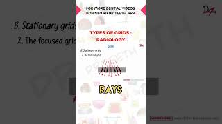 Types of Grids in Radiology [upl. by Disharoon]