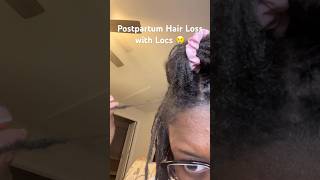 I lost so many locs because of this But the journey continues Updates on my channel locs [upl. by Grieve]