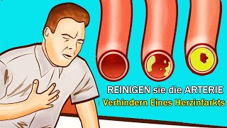 Top 5 Tägliche l Reinigen Die Arterien Und Können Einen Herzinfarkt Verhindern [upl. by Ziegler]