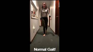 Antalgic Gait Demonstration [upl. by Ermengarde]