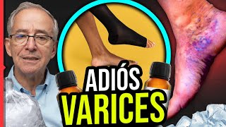 🔴 ADIÓS A LAS VARICES  Oswaldo Restrepo RSC [upl. by Nisaj]