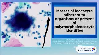 NILM Actinomyces 2018 [upl. by Jaala472]